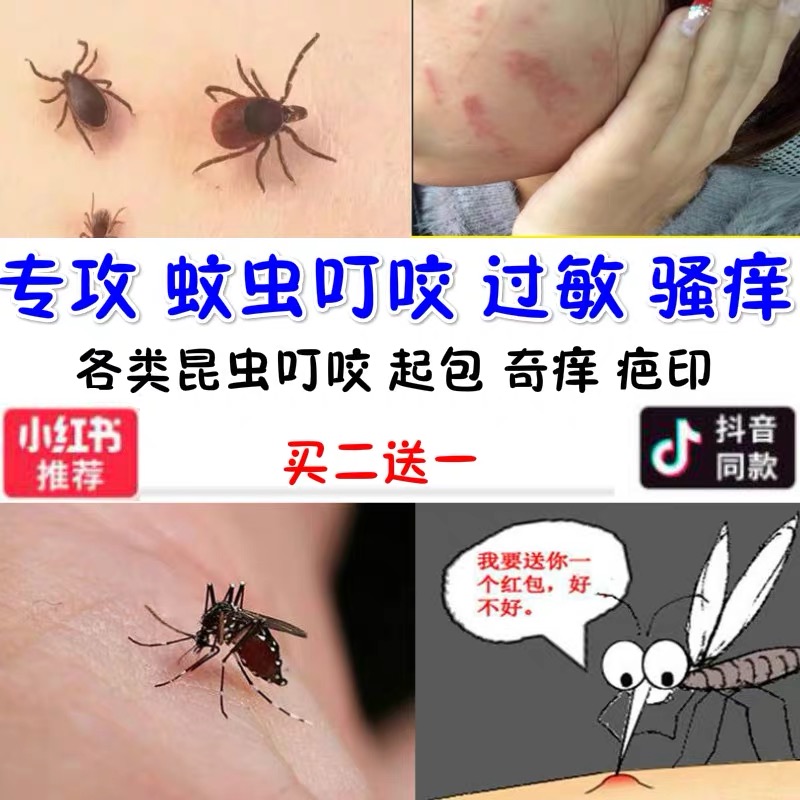 跳蚤蚊虫叮咬止痒膏消大人儿童瘙痒红肿去痱子疤印湿疹外用药膏