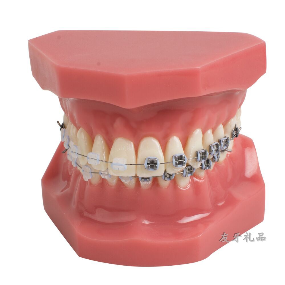 牙齿模型 口腔模型 正畸牙齿模型 一半陶瓷一半金属托槽 教学模型
