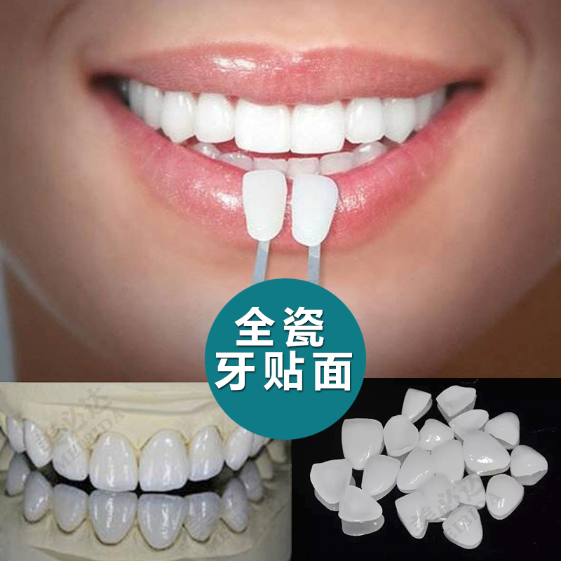 美必达全瓷贴面牙齿美白贴片超薄纳米树脂厂家网红同款牙科材料
