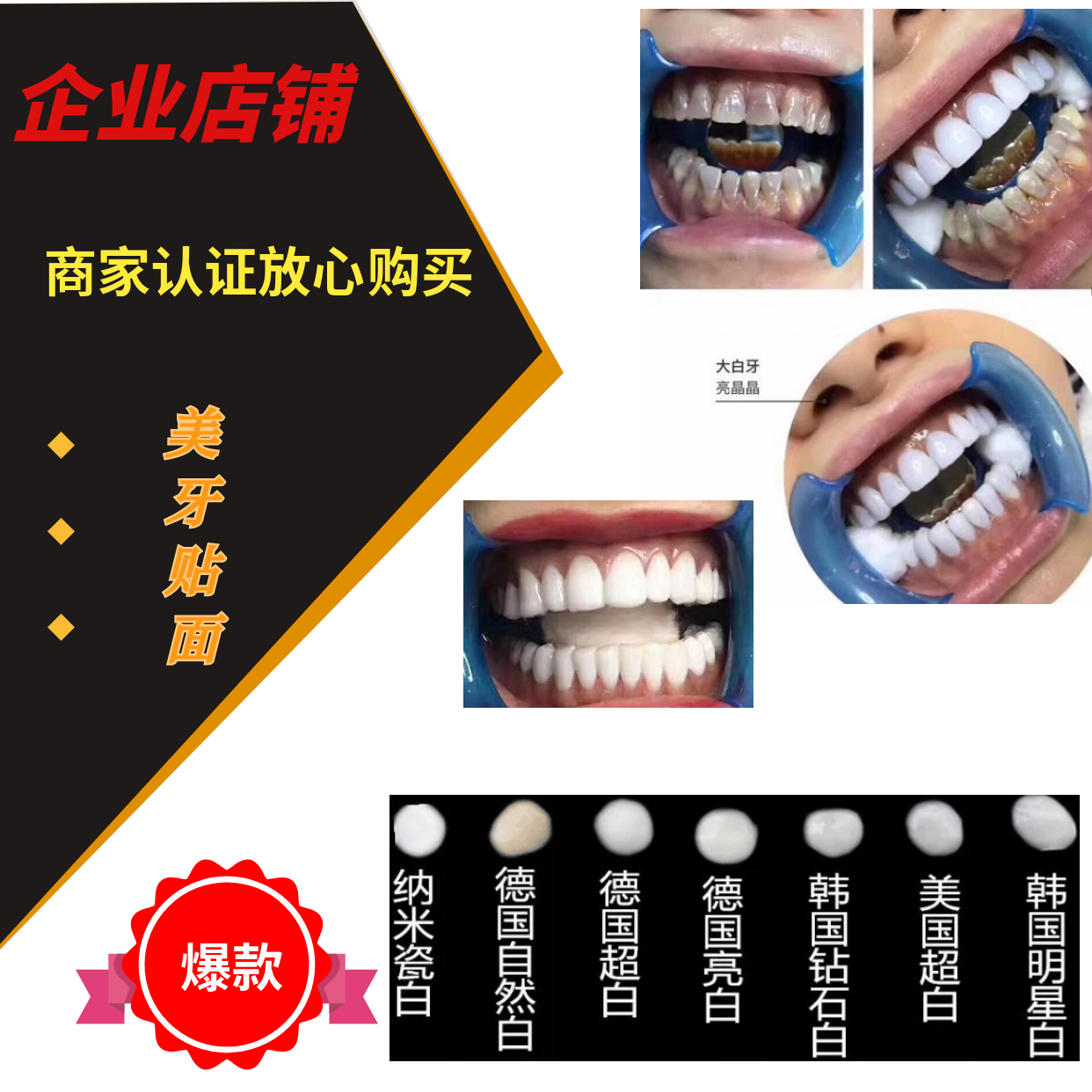 6d纳米炫齿浮雕bl冰瓷贴面牙齿贴片美牙材料原装进口保证正品树脂