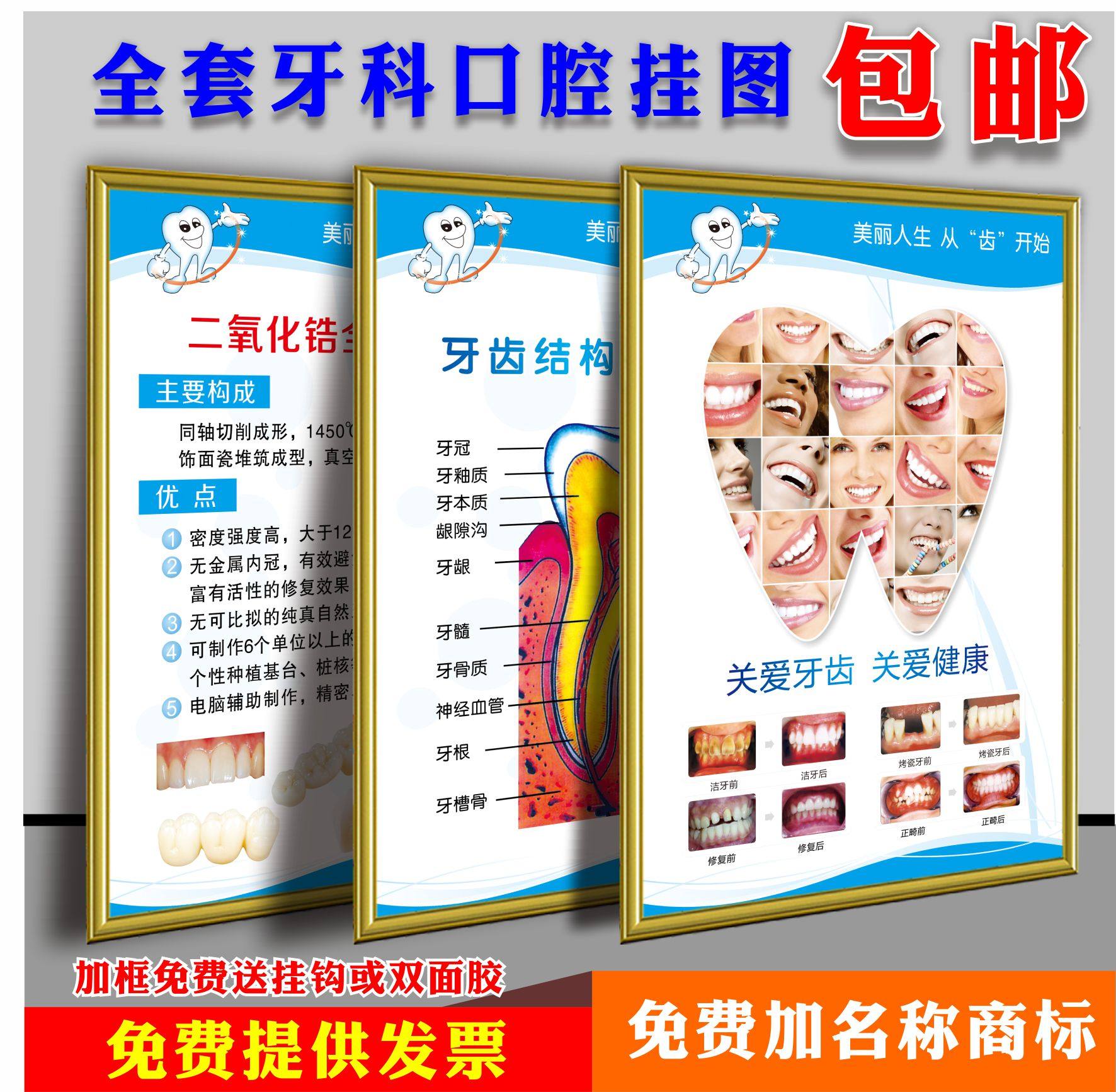牙科诊所烤瓷牙解剖海报牙科挂图口腔知识宣传画kt板定制挂画贴纸